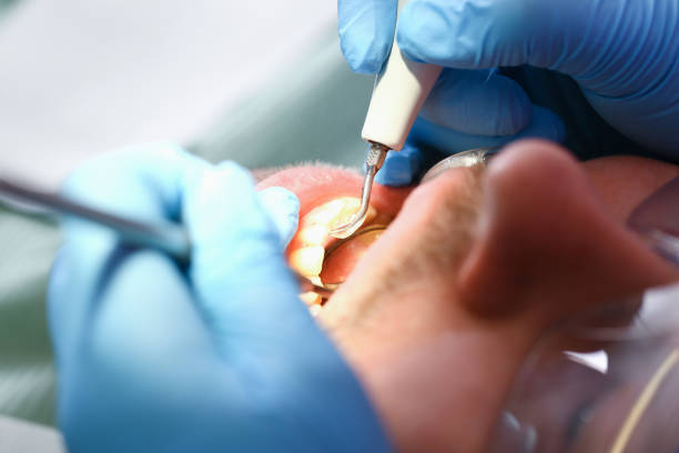 Best Emergency Gum Treatment in Dry Ridge, OH